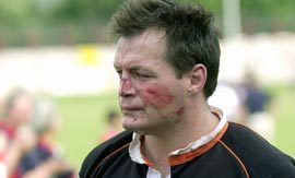 Steve Molloy show the scars of battle - June 22nd 2003.