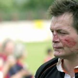 Steve Molloy show the scars of battle - June 22nd 2003.